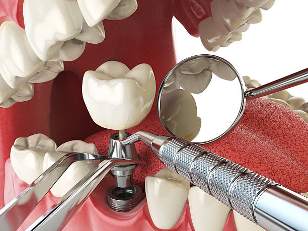 Best Emergency Treatment for Oral Infections in Tonka Bay, MN